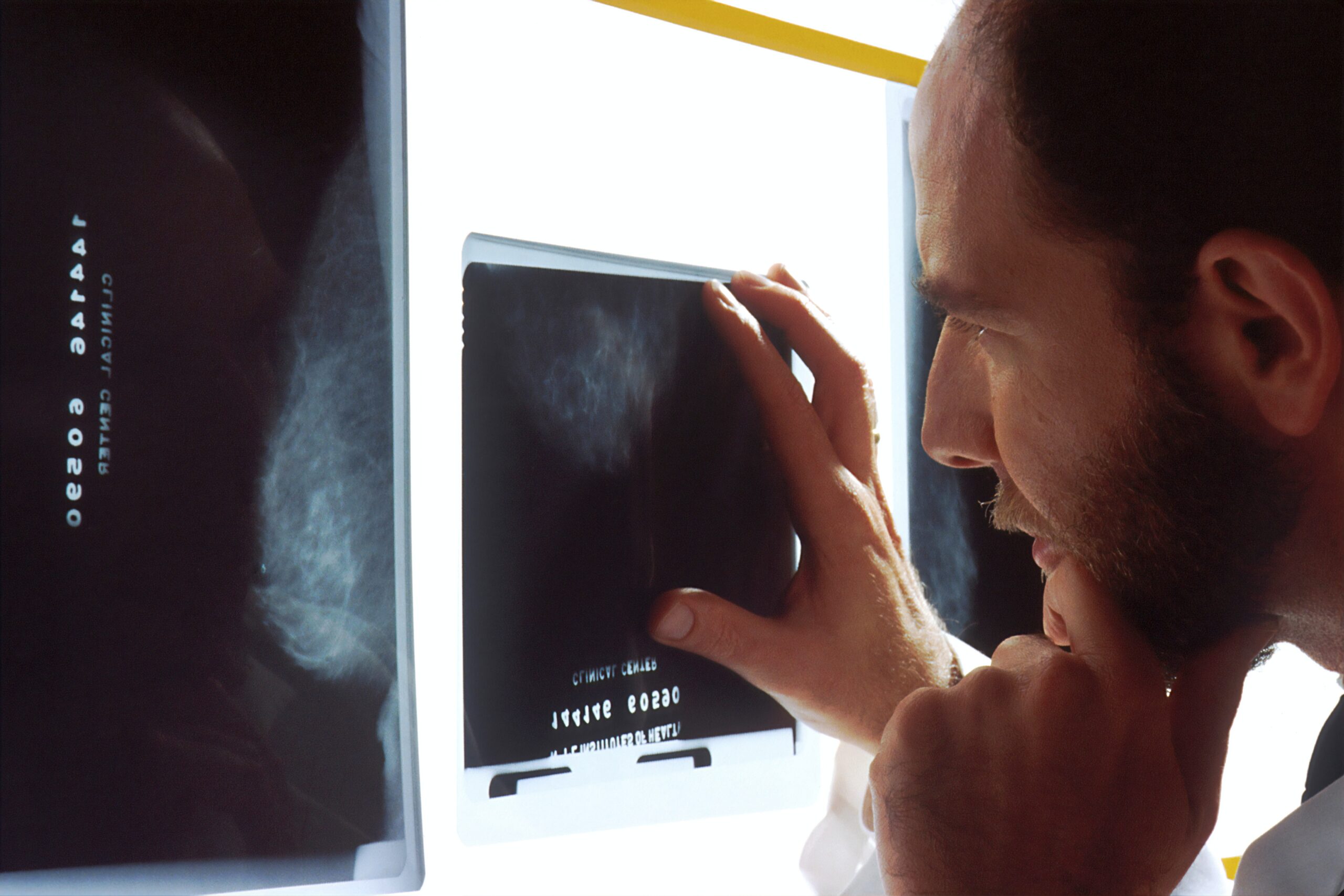 L’AI equivale a due radiologi | The Guardian